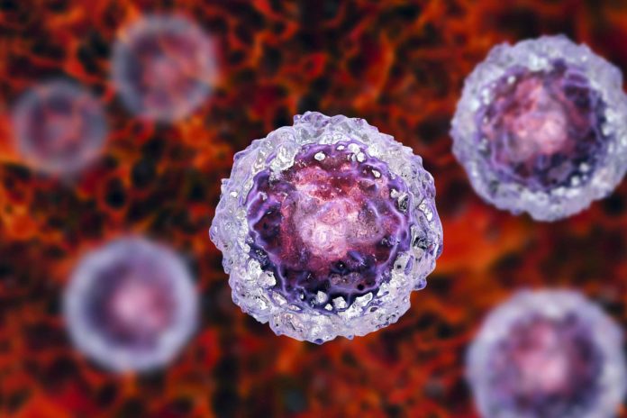 OPINION: Stem Cell Therapy – How I Became a Patient Advocate