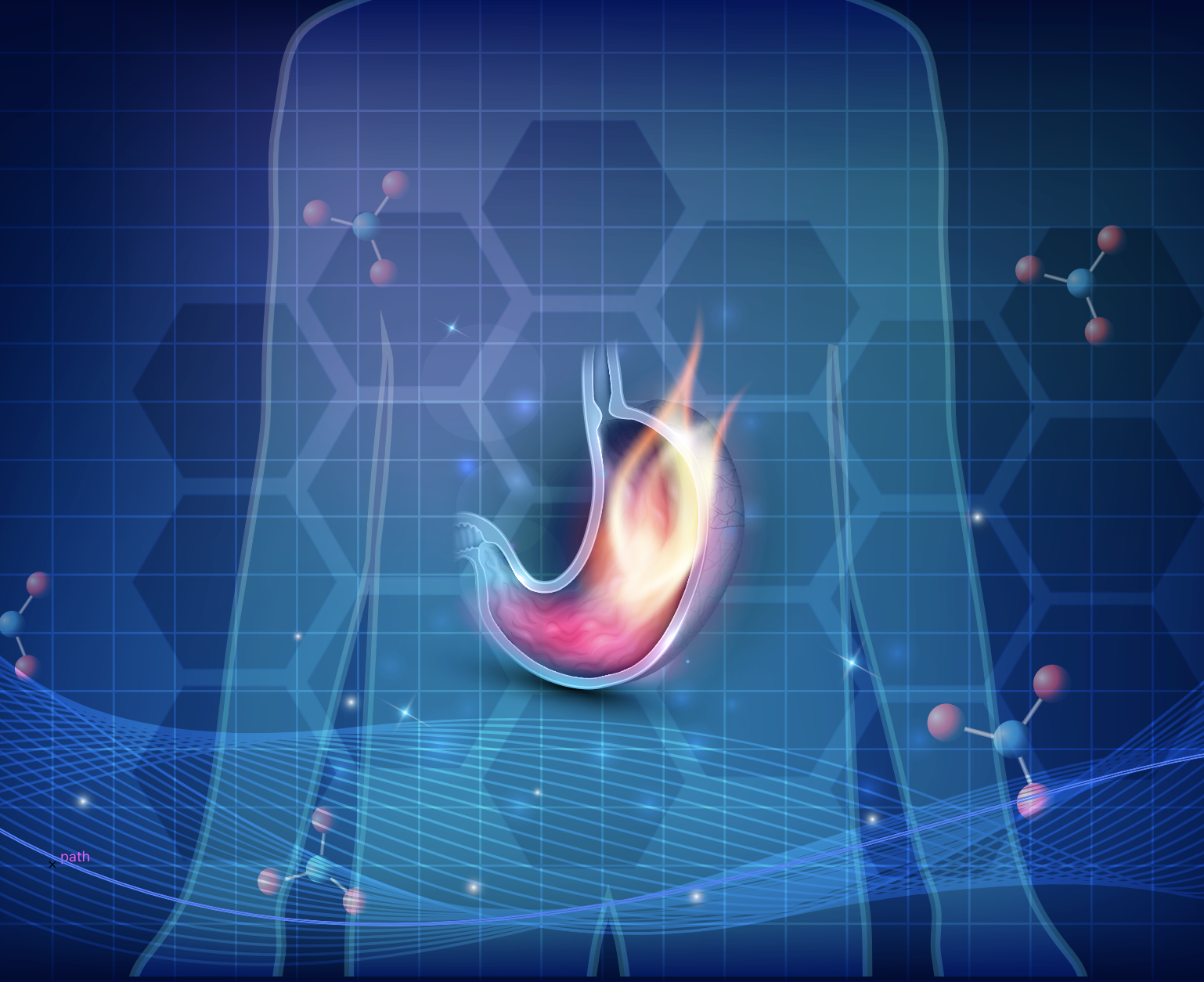 GERD Concept stomach on fire blue background 1538 x 1254
