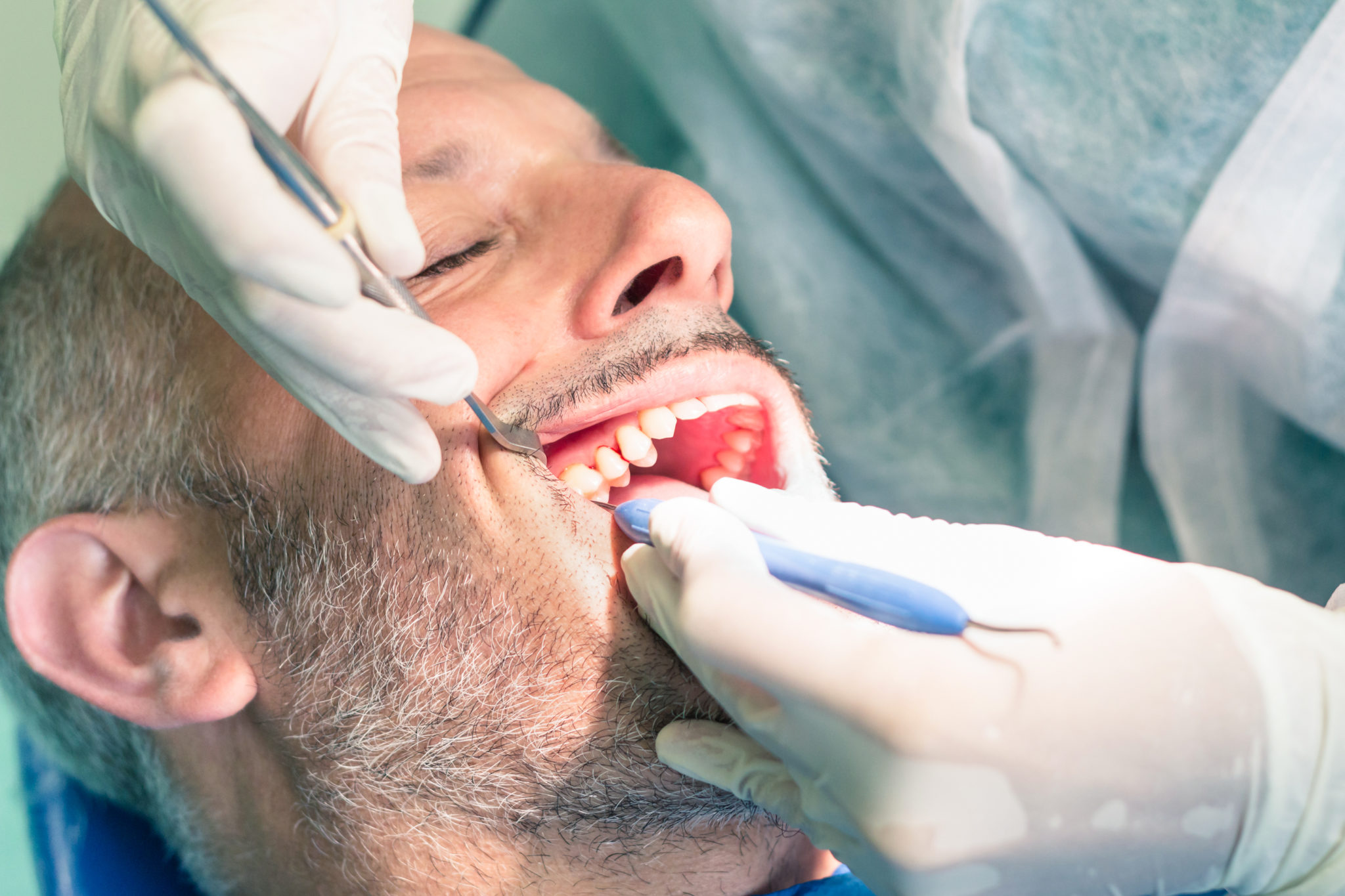 periodontitis systemic disease man getting teeth cleaned