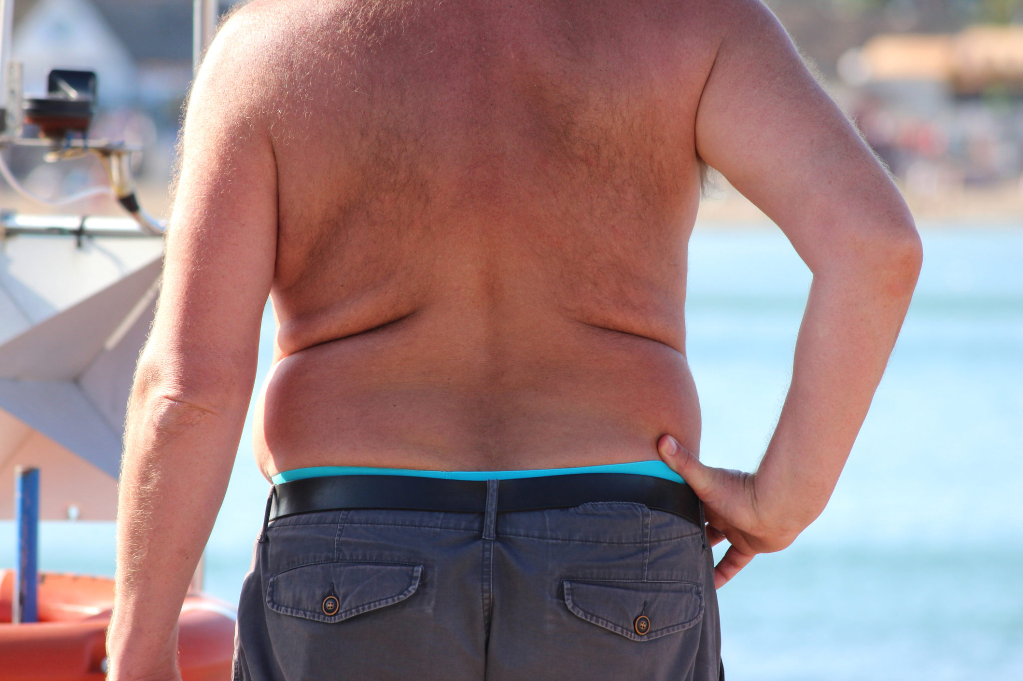 body dysmorphic syndrome - obese mand from behind