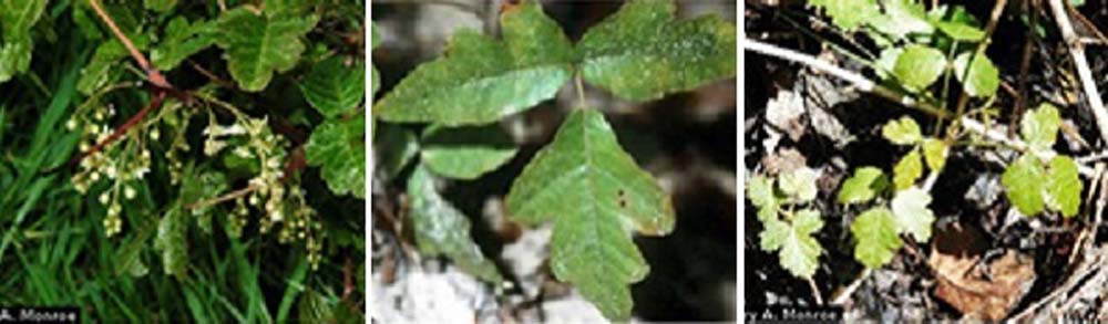 poison oak for poison ivy dermatitis story