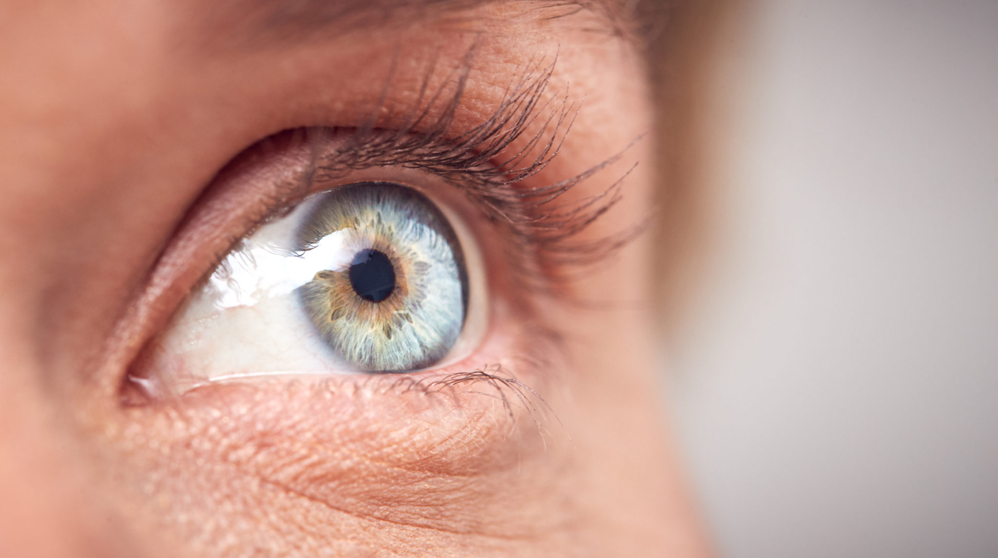 rare-eye-disease-eye-closeup