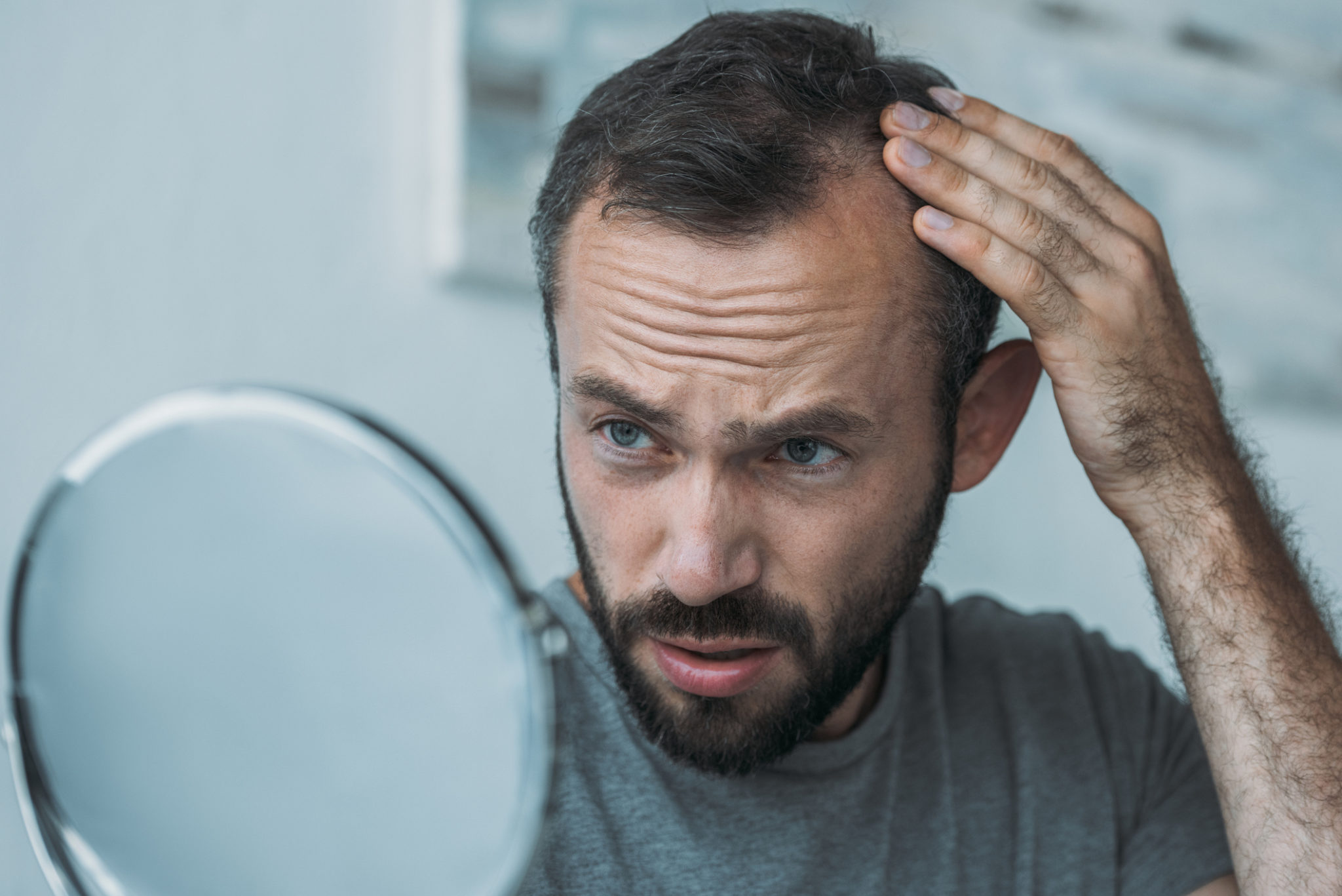 hair regrowth treatments balding man